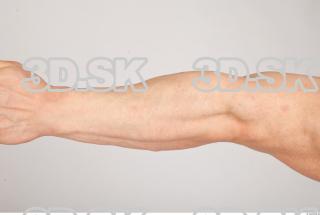 Forearm texture of Gene 0001